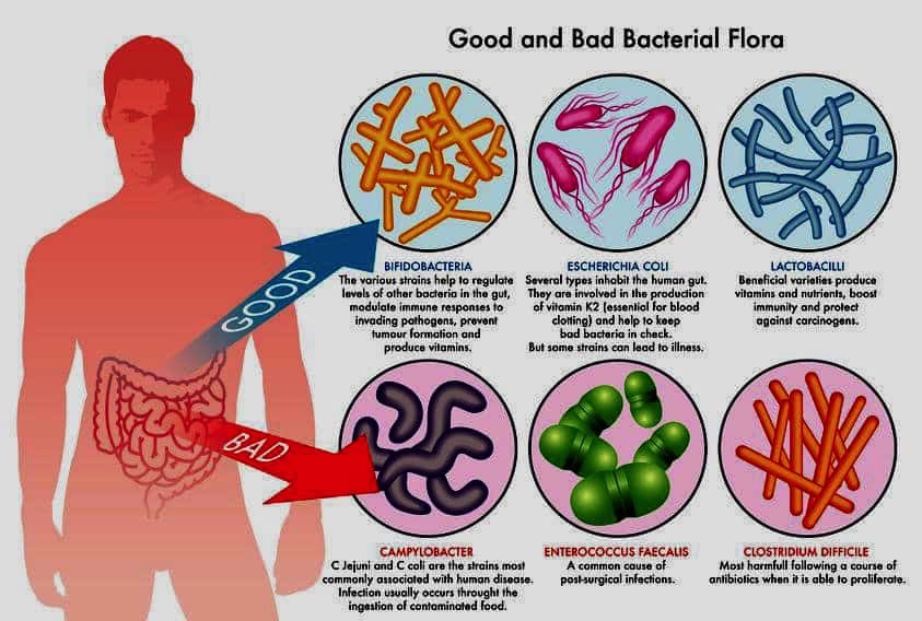 leaky gut syndrome